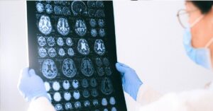 What Are The Long Term Costs of Traumatic Brain Injuries